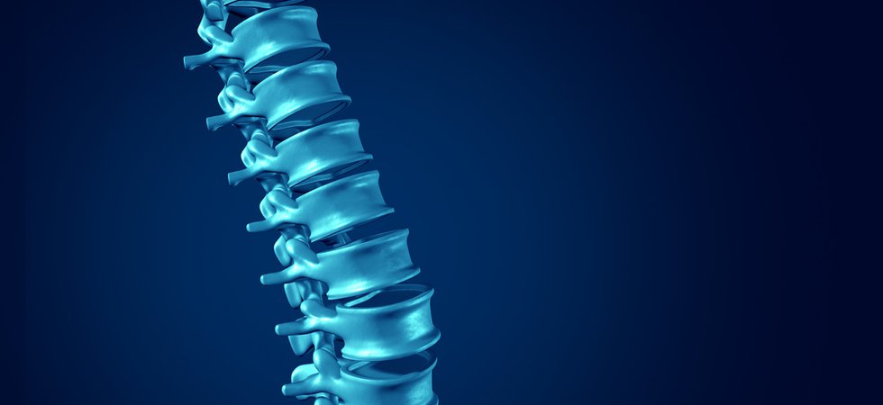 spinal implant.jpg