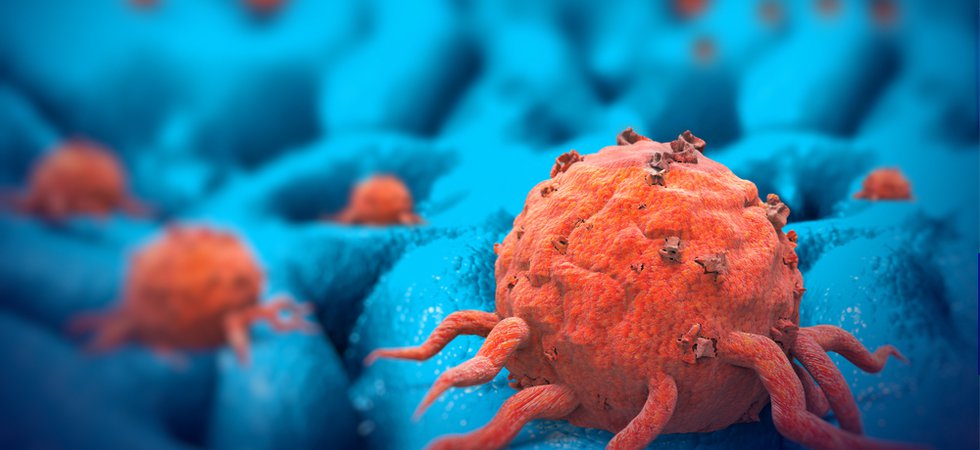 cancer cells.jpg