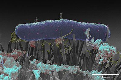6 April E-coli bacteria - thumb.jpg