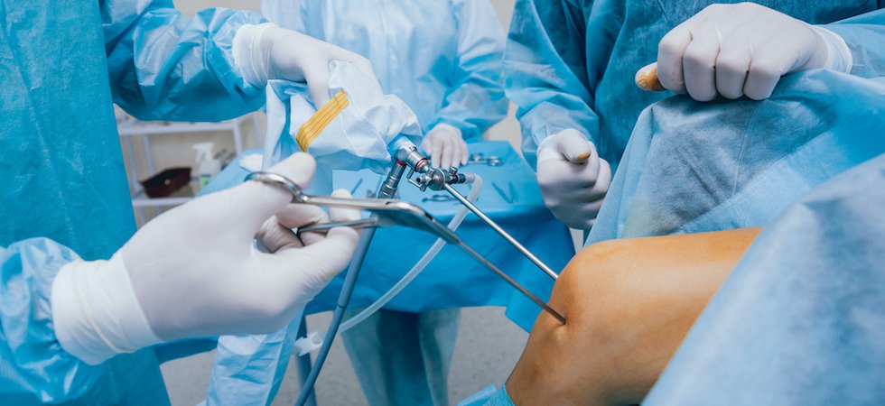 Arthroscope surgery. Orthopedic surgeons in teamwork in the operating room with modern arthroscopic tools. Knee surgery.