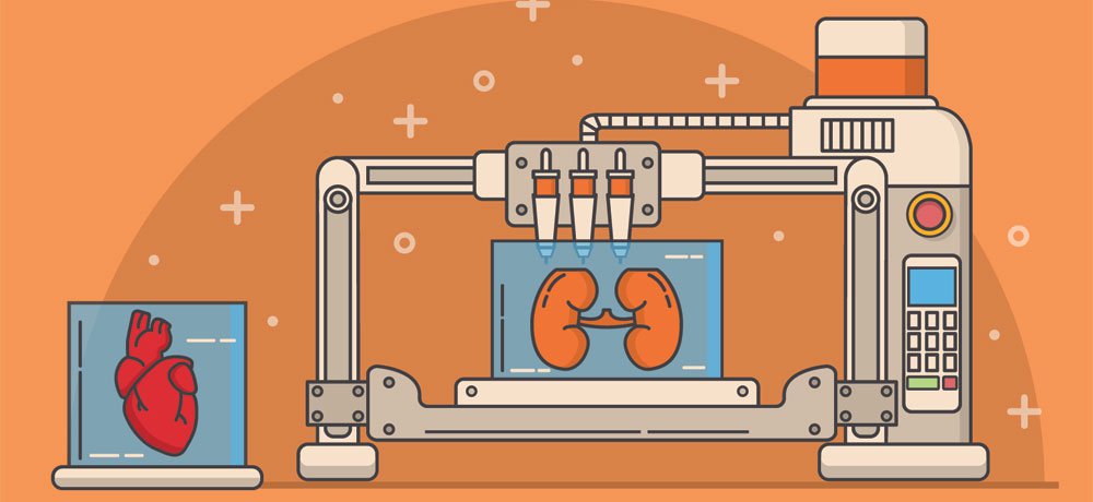3D printing leads to a 'medical first' during kidney transplant - Med-Tech  Innovation
