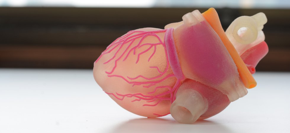 3D printed heart
