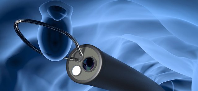 Endoscopy Diagnosis and Treatment with AI Implementation_IMG1.jpg